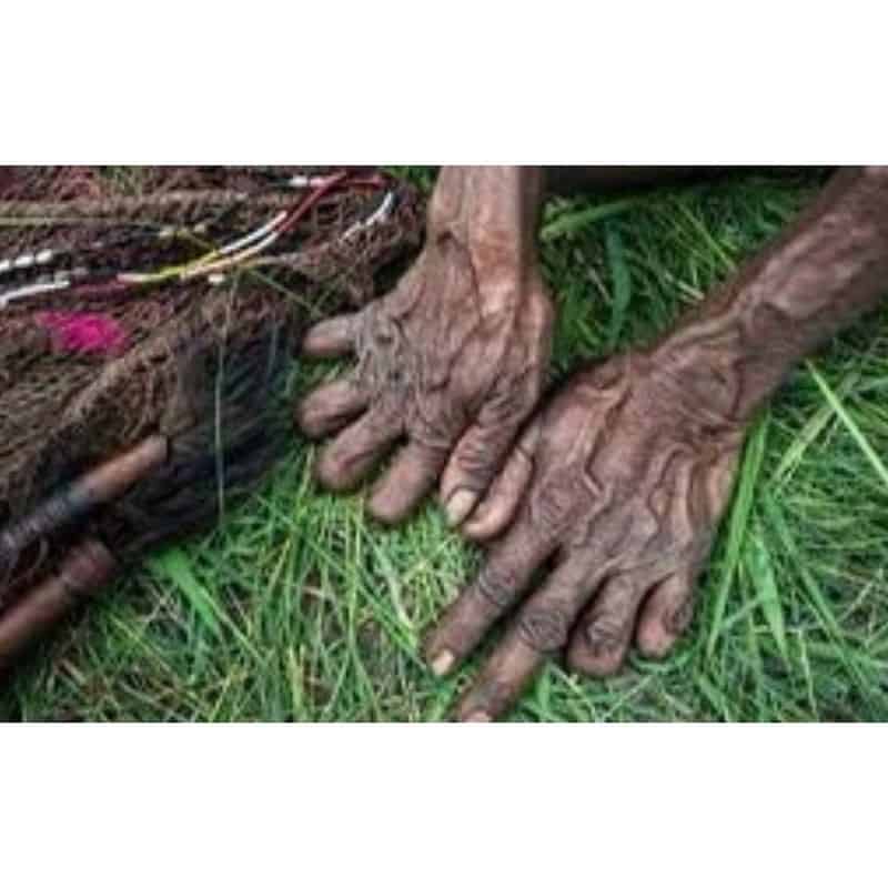 Ritual Finger Amputation: The Dani People's Grief
