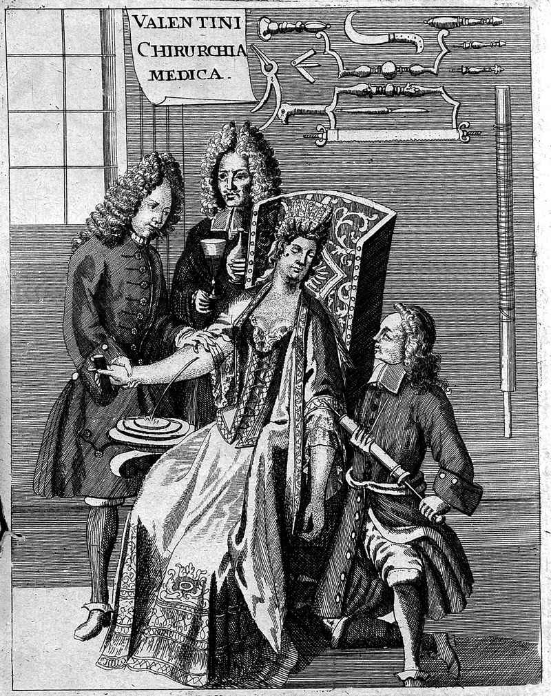 Bloodletting as a Miracle Cure