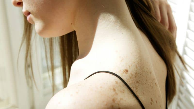 Back Markings: Past Life Imprints