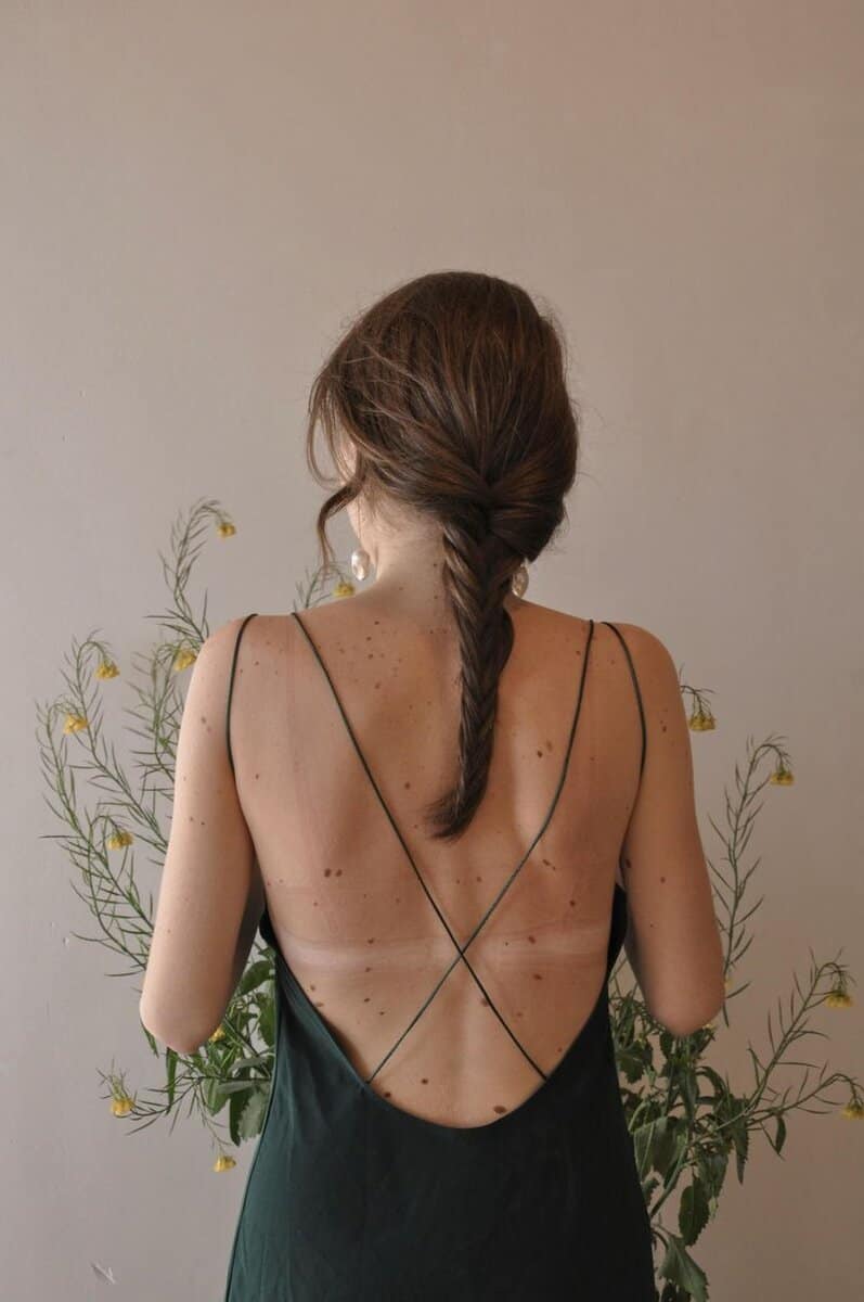Birthmark Connections: Soul Contracts