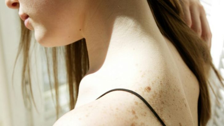 The Spiritual Meaning of Beauty Marks On Your Body