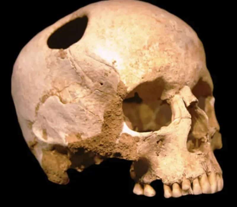 Whispering to Ancestral Skulls